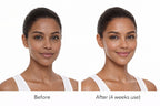 Before and after facial skincare comparison showing the appearance of skin tone and radiance