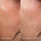 Medik8 Crystal Retinal 10 before and after one tube comparison showing smoother-looking skin texture and reduced appearance of fine lines on the face.