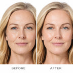 Before and after facial comparison showing smoother, more hydrated-looking skin, illustrating Medik8 Total Moisture Daily Facial Cream 50ml skincare results. Copy