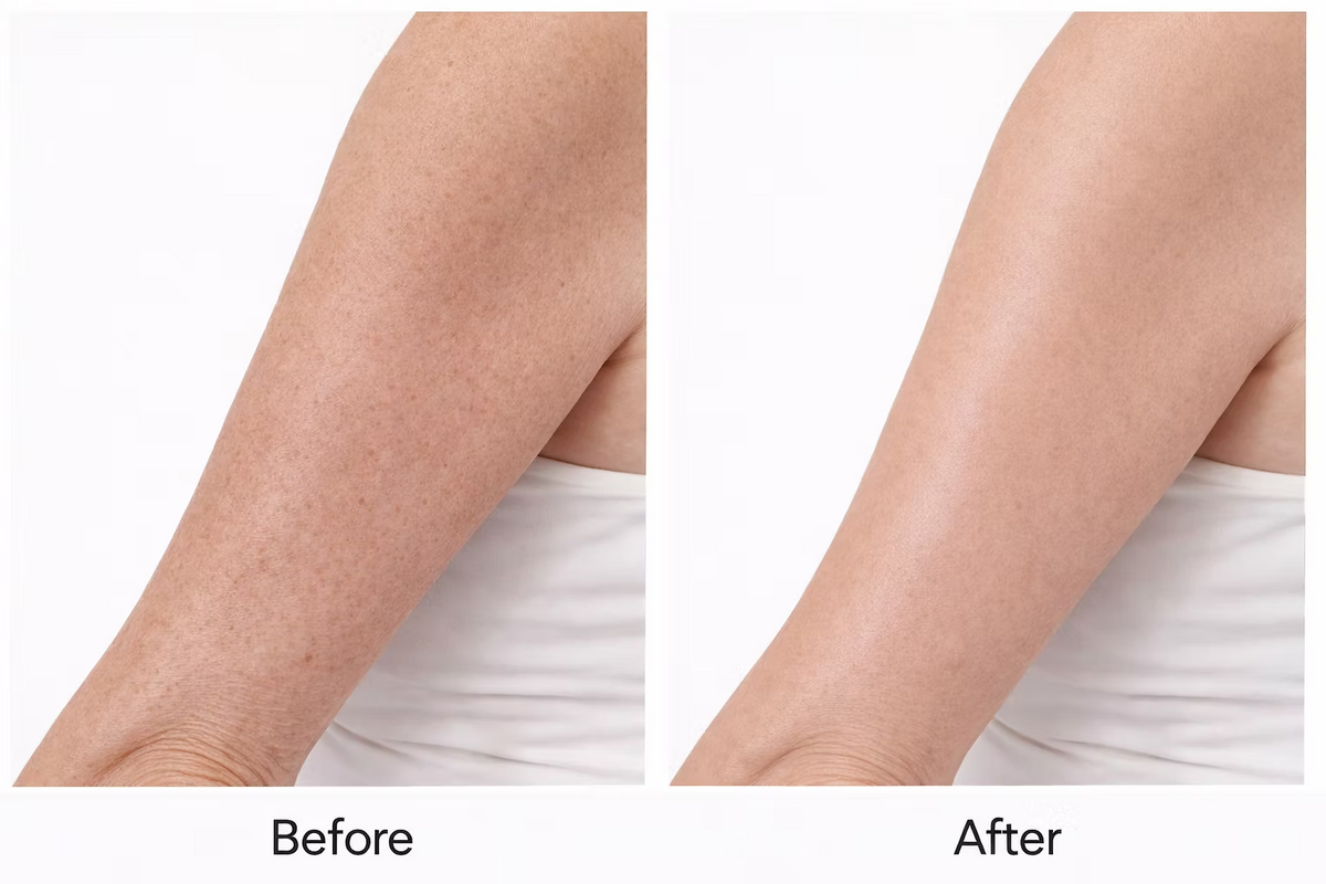Before and after comparison of arm skin showing visibly smoother, more even-looking skin texture in an image promoting the Medik8 Smooth Body Exfoliating Kit.