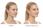 Side-by-side portraits of a woman's facial skin illustrating differences in skin appearance.