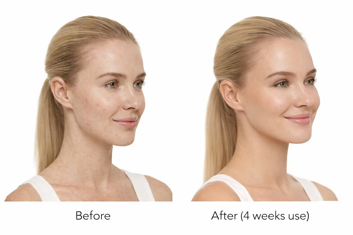 Side-by-side portraits of a woman's facial skin illustrating differences in skin appearance.