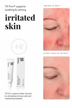 TR Pro+ Post-Procedure Skin Repair Gel 10g before-and-after comparison showing visibly reduced facial redness and irritation after 7 days of use, with product tube and packaging.
